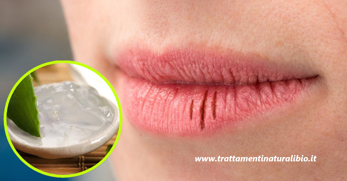 5 rimedi naturali a cui ricorrere in caso di bocca secca