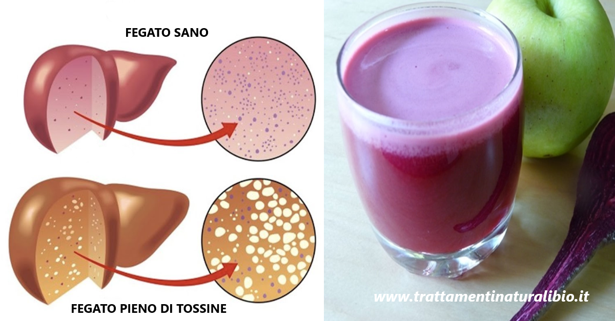 Il succo che pulisce il fegato, combatte l’anemia e depura il sangue Il succo che pulisce il fegato, combatte l’anemia e depura il sangue