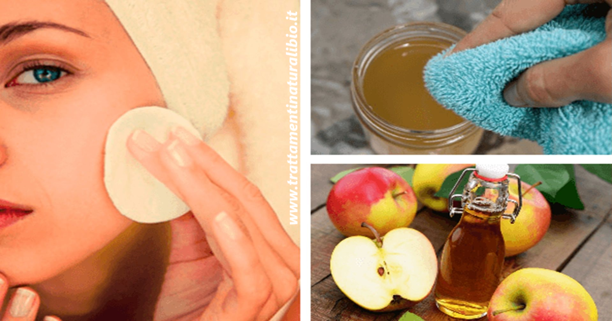 Lavare il viso con aceto di mele per 5 giorni può dare benefici incredibili, ecco come fare Lavare il viso con aceto di mele per 5 giorni può dare benefici incredibili, ecco come fare