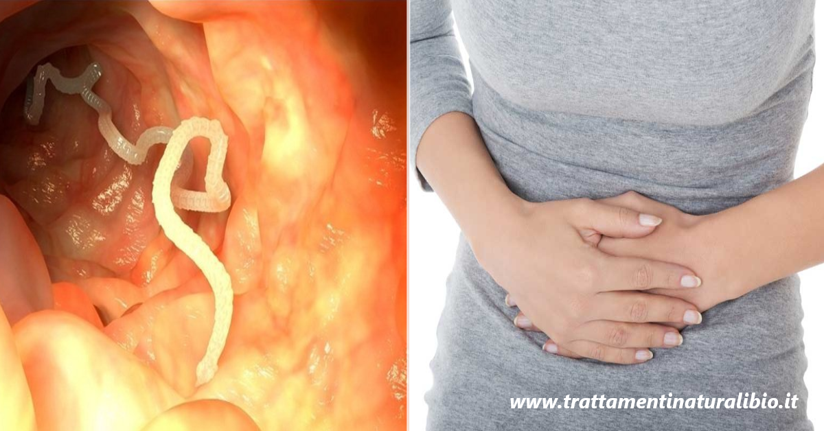 L’80% della popolazione mondiale è infestata da parassiti intestinali. Ecco 5 rimedi per eliminarli in modo efficace e naturale L’80% della popolazione mondiale è infestata da parassiti intestinali. Ecco 5 rimedi per eliminarli in modo efficace e naturale