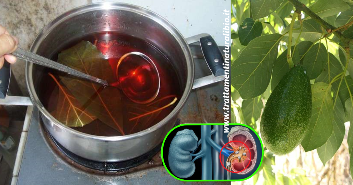L’infuso che depura i reni, elimina i calcoli e le infezioni urinarie L’infuso che depura i reni, elimina i calcoli e le infezioni urinarie