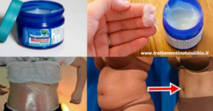 Vicks Vaporub, Canfora e Bicarbonato: l'unguento che elimina una taglia a settimana
