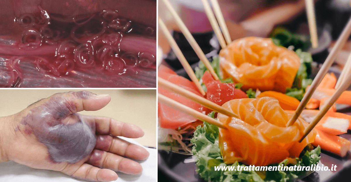 Sushi tutti i pericoli nascosti che sicuramente non conosci Sushi: tutti i pericoli nascosti che sicuramente non conosci