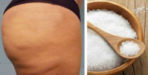 Cellulite: ecco come eliminarla per sempre con zucchero e sale