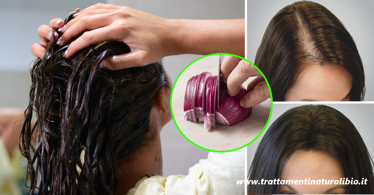 Come far ricrescere i capelli in pochi giorni con la cipolla Come far ricrescere i capelli in pochi giorni con la cipolla