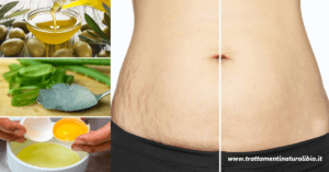 Come eliminare le smagliature della pancia per sempre e in modo naturale