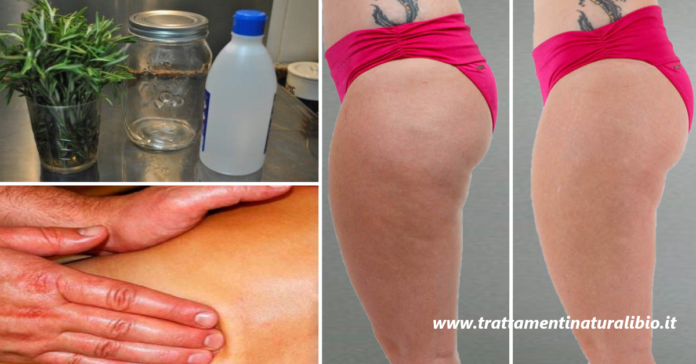 Come eliminare velocemente la cellulite con l’alcol al rosmarino
