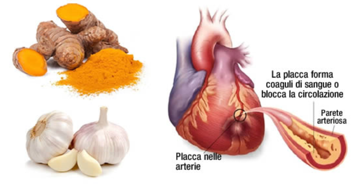 Come sbloccare le arterie ostruite in modo naturale Come sbloccare le arterie ostruite in modo naturale