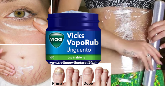 20 usi alternativi del Vicks Vaporub che sicuramente non conosci 20 usi alternativi del Vicks Vaporub che sicuramente non conosci