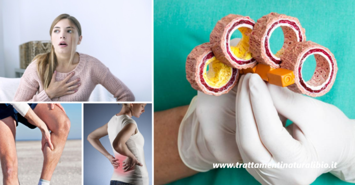 Arterie ostruite 7 sintomi premonitori che possono salvarti la vita Arterie ostruite: 7 sintomi premonitori che possono salvarti la vita
