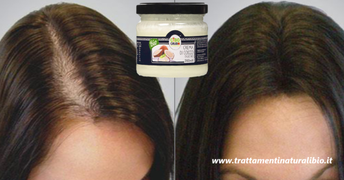 Come usare l'olio di cocco per bloccare la caduta dei capelli e accelerarne la crescita Come usare l'olio di cocco per bloccare la caduta dei capelli e accelerarne la crescita