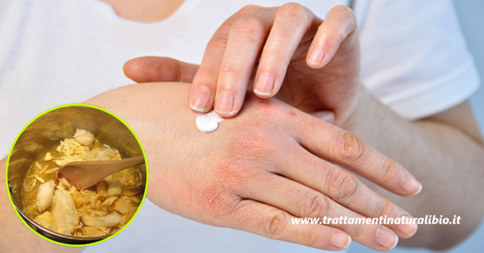 Crema mani fai da te per proteggerle dal freddo e ripararle velocemente Crema mani fai da te per proteggerle dal freddo e ripararle velocemente