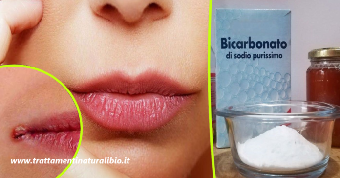 Rimedi naturali per curare velocemente i fastidiosi tagli ai lati della bocca Rimedi naturali per curare velocemente i fastidiosi tagli ai lati della bocca