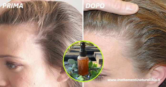 Lozione miracolosa per capelli fai da te che blocca la caduta e accelera la crescita