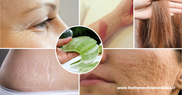 9 incredibili usi di bellezza del gel di Aloe che sicuramente non conosci 9 incredibili usi di bellezza del gel di Aloe che sicuramente non conosci