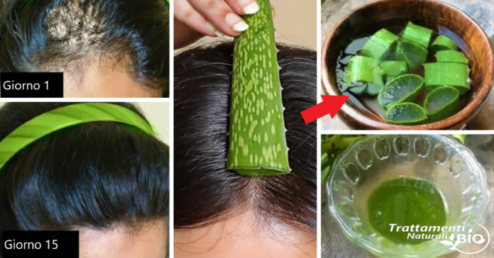 Aloe Vera e Rosmarino il tonico che blocca la caduta dei capelli e accelera la crescita Aloe Vera e Rosmarino: il tonico che blocca la caduta dei capelli e accelera la crescita